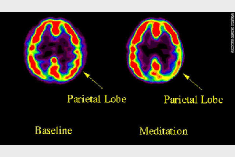 Neurotheology : Is Your Brain Really Spiritual?